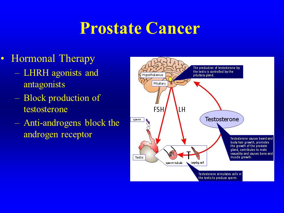 Which hormone is responsible for prostate enlargement